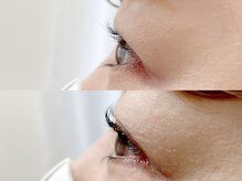 ジョリ アイラッシュ(Jolie eyelash)/上下ラッシュリフト