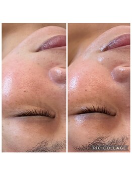 グランデ(Grande)/プラズマニアでお肌の土台作り◎