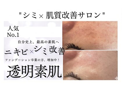 イノエ(inoe)の写真