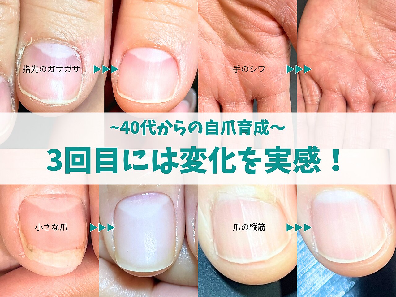 アガベ パリー 美爪 香川県高松市受取対応可能 キラリネイル(KIRARINAIL)｜ホットペッパービューティー