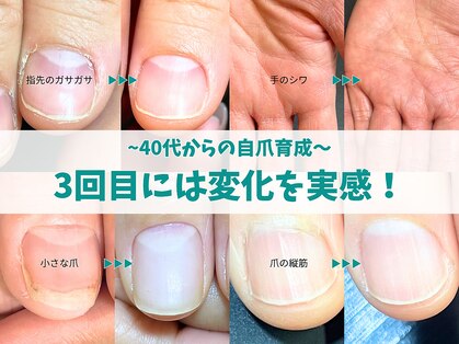 キラリネイル(KIRARINAIL)の写真