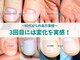 キラリネイル(KIRARINAIL)の写真