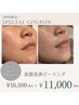 【新規限定◆ニキビ・毛穴汚れにお悩みの方】CHRISTINAトリートメント