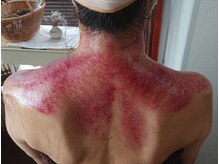 オアシス(OASIS)/最強「デトックスかっさ」1