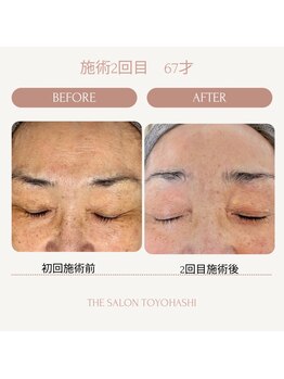 ザ サロン(THE SALON)/モニター様限定◇全メニュー半額