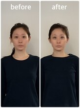美容整体プラスキュー五反田/小顔・目の高さ・大きさ