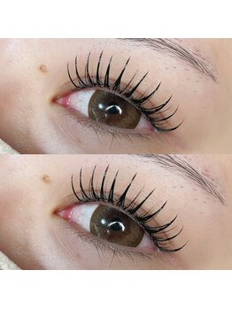 ドース(DOSE)/瞳キラキラ