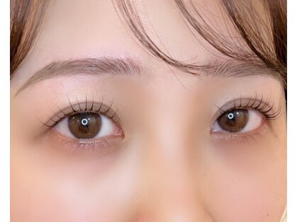 アルム(arme)の写真