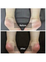 リアン(Lien)/before after