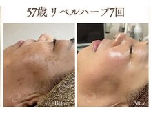 デトックスサロン モーミンの雰囲気（リベルハーブピーリング）