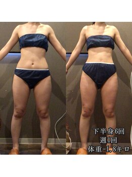 カルム エ コンポーゼ(Calme et Compose')/痩身セルゼロ/下半身6回