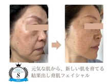 エルブラン(Herb ame)