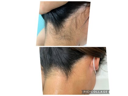 エルサ(Elsa)の写真