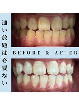 ドルチェ 水戸店(Dolce)/★ before → after ★