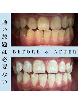 ドルチェ 水戸店(Dolce)/★ before → after ★