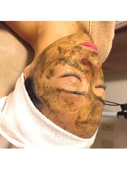 ココ(CoCo)/ハーブピーリング