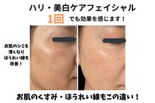 トータルビューティー雅
