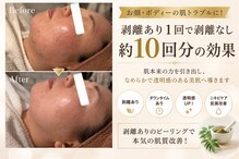 ダイヤモンド リーエンダ(Diamond leende)