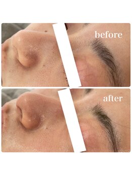 エステサロンブランシュ(Esthe salon Blanche)/ハーブピーリングで毛穴ケア