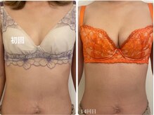 美人バスト 渋谷店/【バストアップ・育乳】症例☆