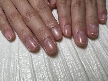 エードット(A.)/