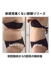 アンヘル(Angel)/健康的にサイズダウン