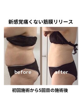 アンヘル(Angel)/健康的にサイズダウン