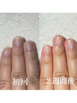 スティラ(Stila)/自爪育成/深爪育成/ネイルケア