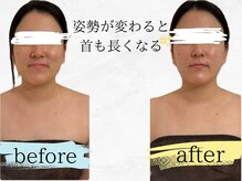 ヨサパーク シアー(YOSA PARK sheer)の雰囲気（見た目から内側まで、沢山の嬉しい変化を是非楽しんで下さい★）