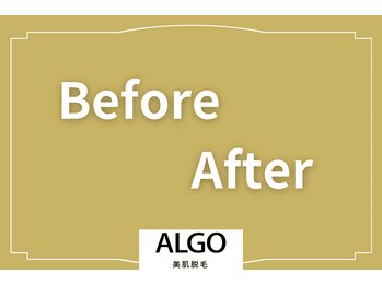 アルゴ 山口宇部店(ALGO)/Before→Afterをご紹介♪