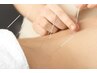 【鍼灸＋マッサージ】上半身or下半身を鍼の力で根本改善！¥6600→¥4950