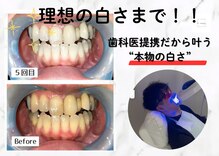 ルカノン(le canon)