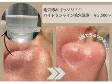 今治市で毛穴ケアが人気のエステサロン｜ホットペッパービューティー 毛穴エステ 込900円