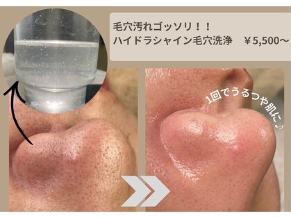 ミオン(Mion)の写真