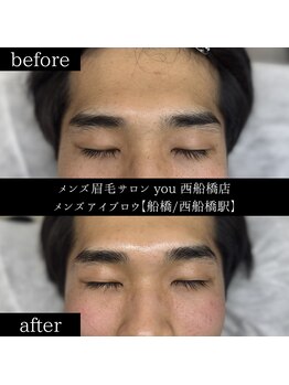 ユー 西船橋店(you)/ビフォーアフター写真