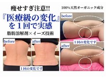 イーズ ミュゼ  ららぽーと横浜店