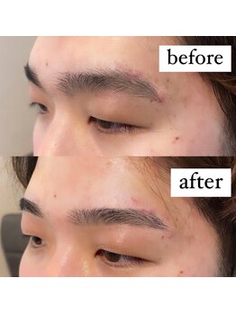 サムライビューティー 西新宿本店(SamuraiBeauty)/メンズ眉毛施術のBefore l After