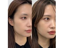 ハリウッドブロウリフト ワクシー 新宿店(HOLLYWOOD BROW LIFT WAXYYY.)