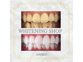 ホワイトニングショップ 尼崎店/ホワイトニング