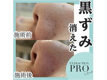 フェイシャルメニューも人気！一度やるとやめられない！