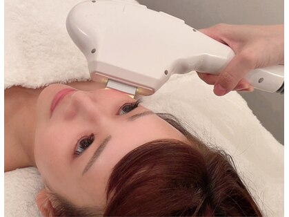 アンノン(Annon)の写真