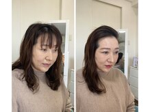 ジブンビューティー(jibun beauty)/ビフォーアフター