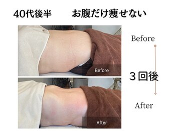 エミフル(emifull)/お腹だけ太ってると思ってたけど