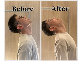 整体ラルース 中目黒(LALUZ)/40代 男性 Before After 初回