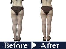 ナースケアラボ(Nurse Care Lab)/結果はこちら一度でこの変化