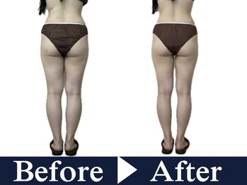 ナースケアラボ(Nurse Care Lab)/結果はこちら一度でこの変化