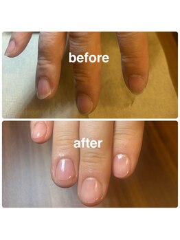 メンズネイルビズ 赤坂(Men's Nail Biz)/MOIST｜うるおい集中リペア