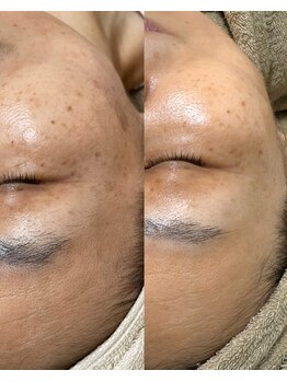 モンクラッシー(Mon classy)/シミも薄く