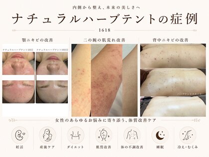 イチロクイチハチ(1618)の写真
