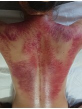 オアシス(OASIS)/最強「デトックスかっさ」2